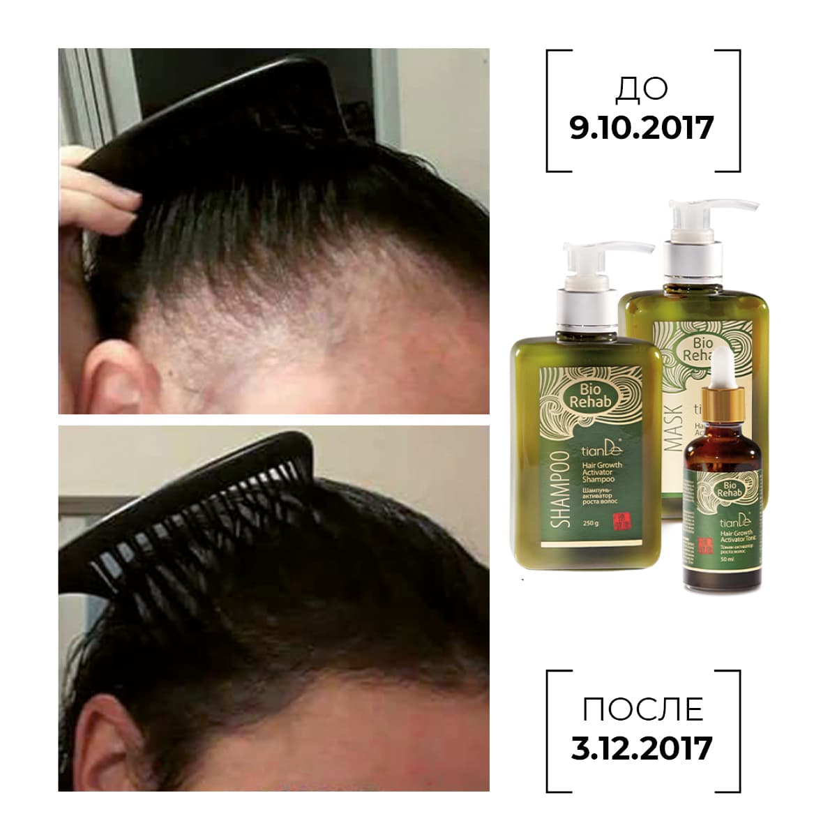 Маска-активатор роста волос Bio Rehab - view 8